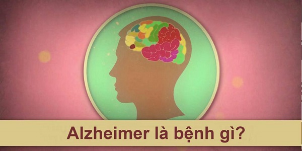 alzheimer là bệnh gì và hình ảnh minh họa